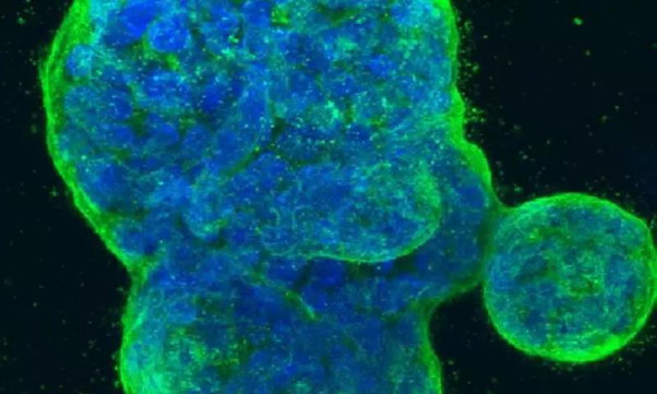 Study finds new mechanism for inhibiting the potential spread of breast cancer